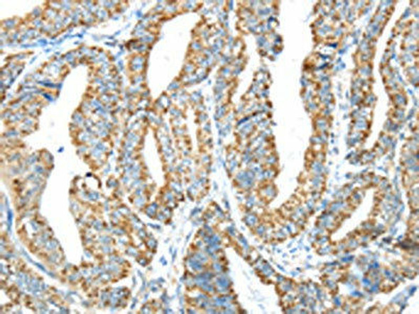 IFNA2 Antibody (PACO19812)