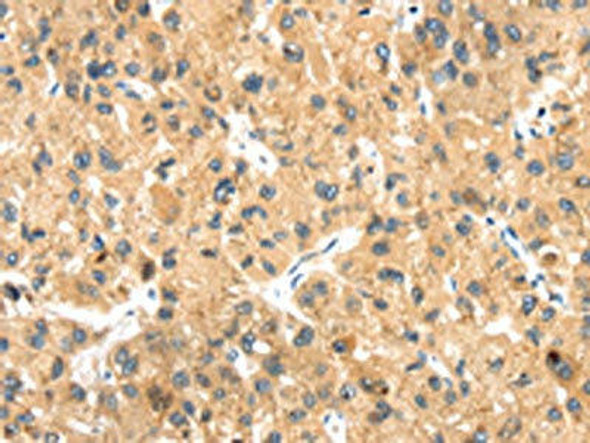 LLGL2 Antibody (PACO19947)