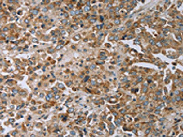 TNPO1 Antibody (PACO20025)