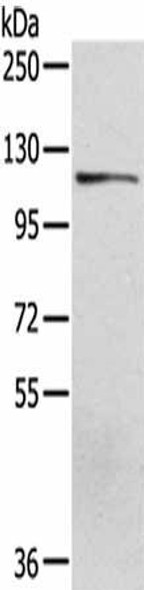 UBA1 Antibody (PACO20805)