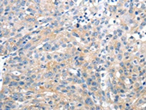 UCP2 Antibody (PACO20816)