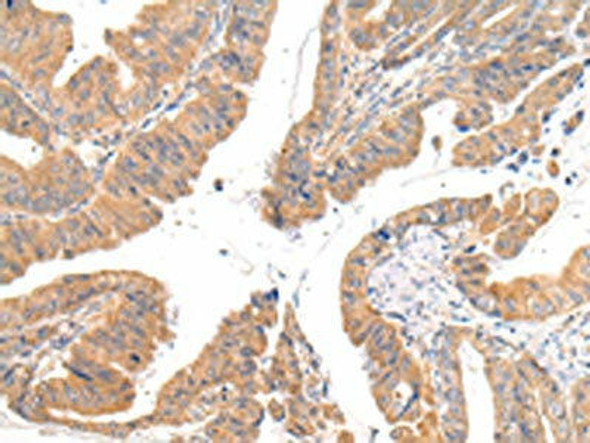 CMKLR1 Antibody (PACO21012)