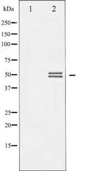 GSK3A Antibody (PACO21322)