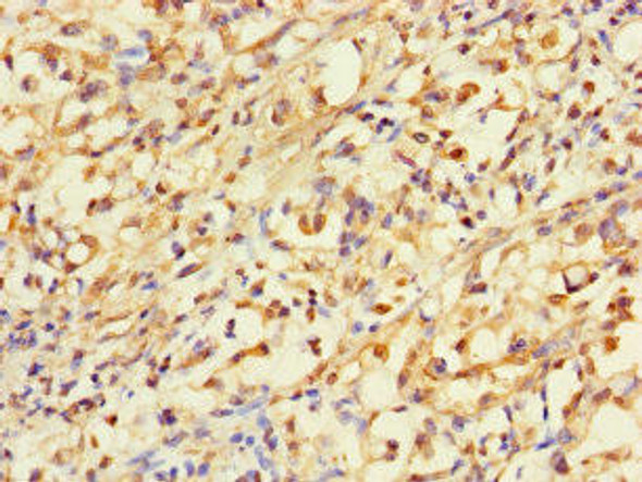 ACLY Antibody (PACO24720)