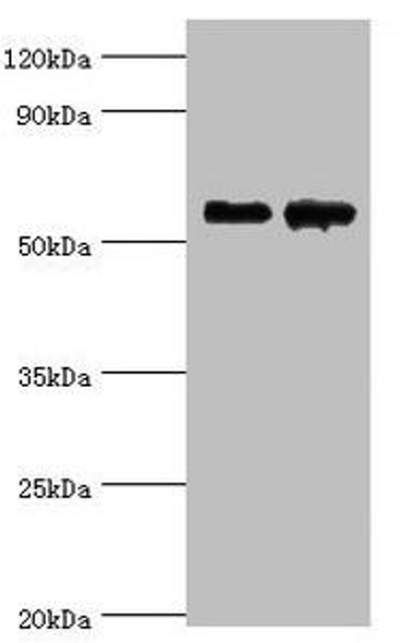 CNDP1 Antibody (PACO43626)