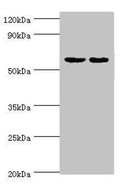 DGKE Antibody (PACO43727)