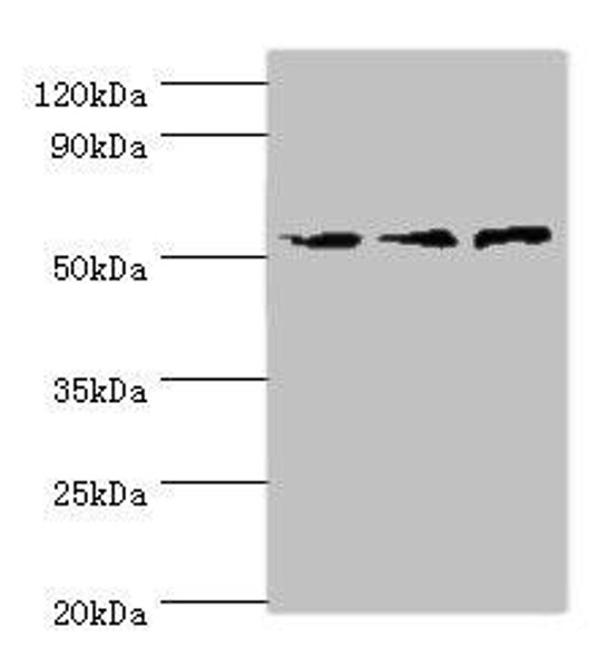 ACVR1C Antibody (PACO43776)