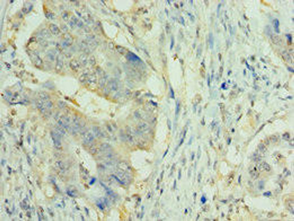 NLRP2 Antibody (PACO43820)