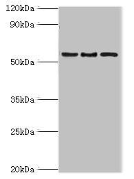 ARFGAP3 Antibody (PACO43937)