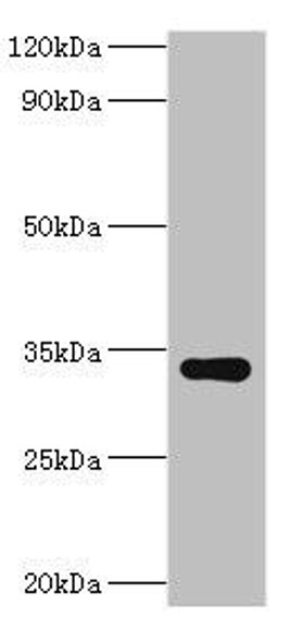 HYLS1 Antibody (PACO43962)