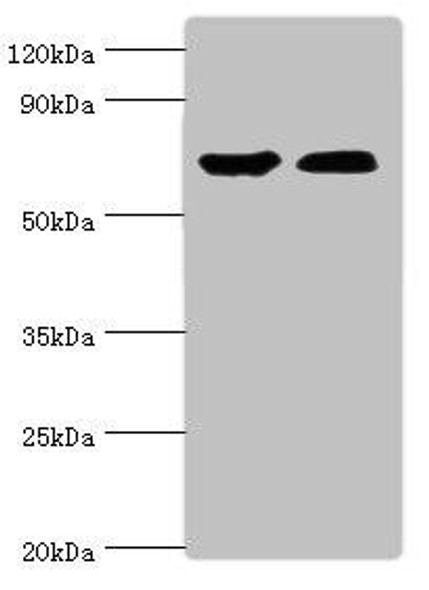 CROT Antibody (PACO43996)