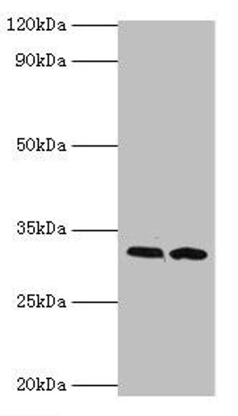 RDM1 Antibody (PACO44023)