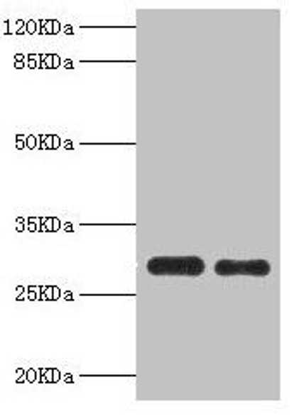 PSME1 Antibody (PACO44183)