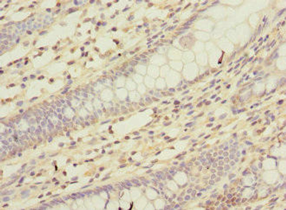 KCND2 Antibody (PACO44192)