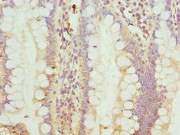 TCIM Antibody (PACO44232)