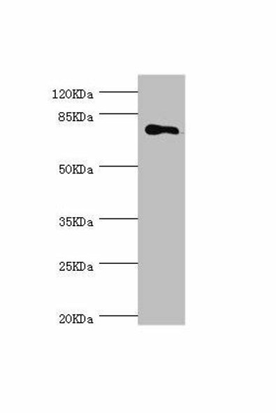 MGAT1 Antibody (PACO44266)