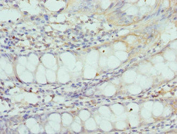 CNGA3 Antibody (PACO44323)