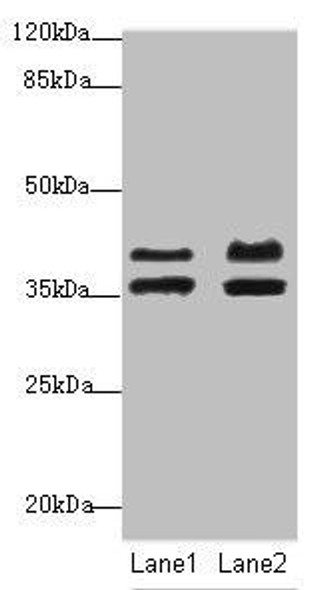 IKBIP Antibody (PACO44580)