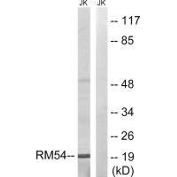 MRPL54 Antibody (PACO23352)