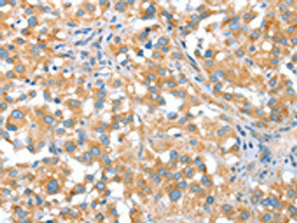 ST14 Antibody (PACO14686)