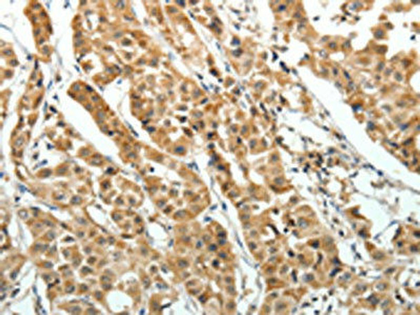 EIF2AK3 Antibody (PACO14869)