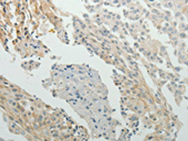 SPATA17 Antibody (PACO15063)