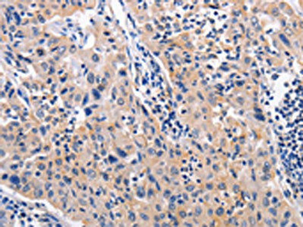 AKR1B10 Antibody (PACO15364)