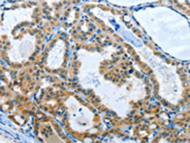 RPL15 Antibody (PACO15457)