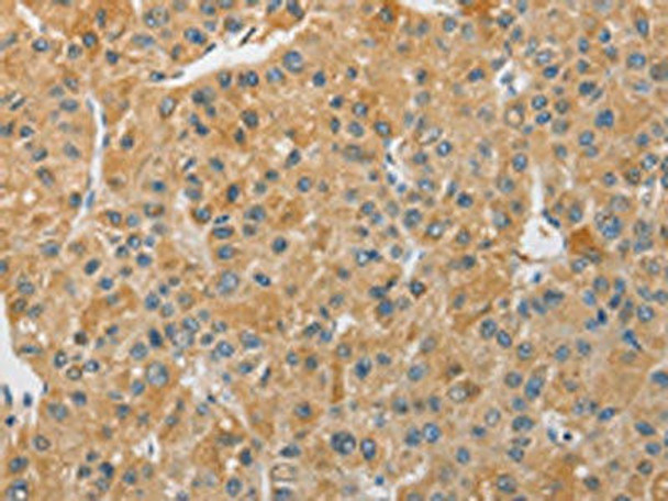 ARHGAP15 Antibody (PACO15507)
