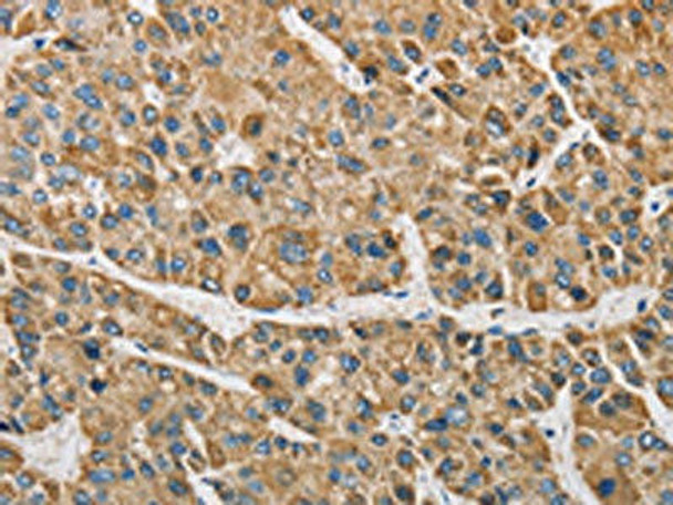 ARHGAP25 Antibody (PACO15508)