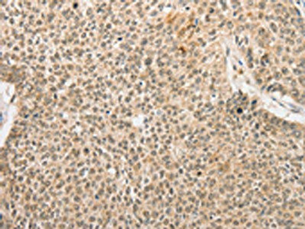 RPL26L1 Antibody (PACO15599)