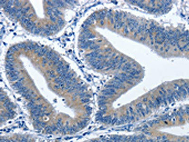 CDK5RAP3 Antibody (PACO15996)