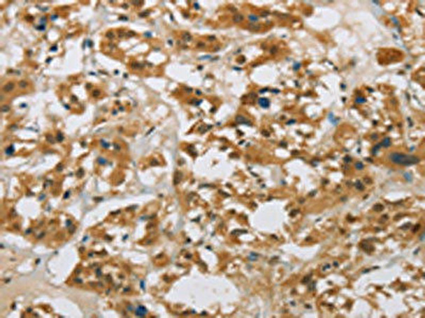 CYP11B1 Antibody (PACO16106)