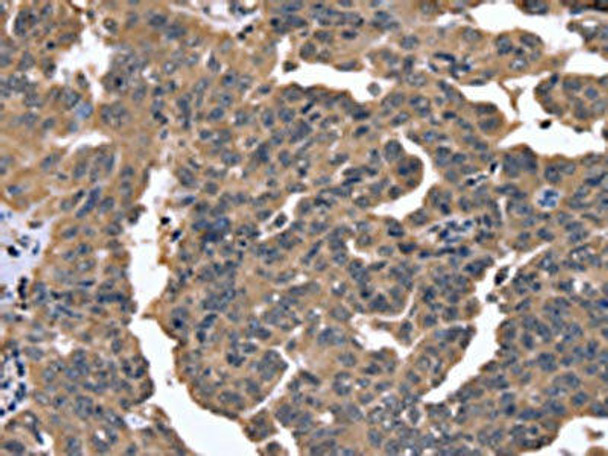 FGFR1OP2 Antibody (PACO16343)