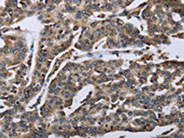 DDX11 Antibody (PACO16604)