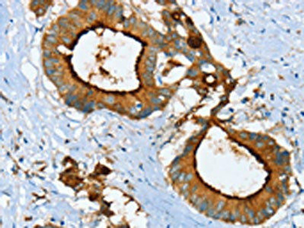 LGALS3BP Antibody (PACO16617)