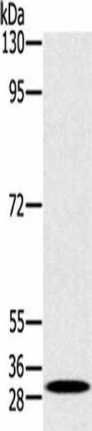 RAB27A Antibody (PACO16926)