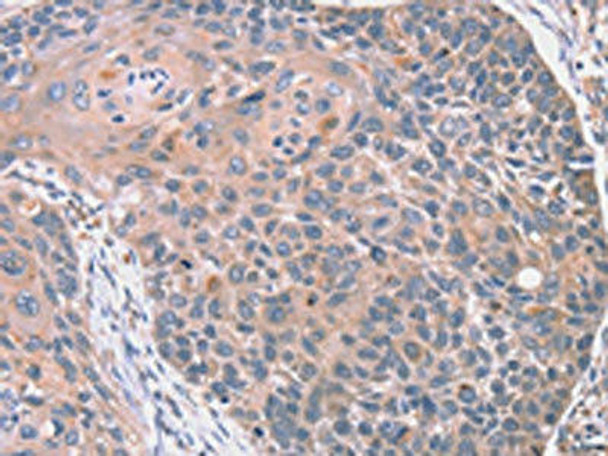 RGS10 Antibody (PACO16974)