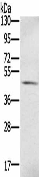 S100PBP Antibody (PACO17041)