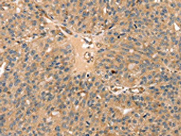 SSX2IP Antibody (PACO17155)