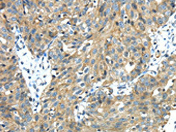 TMPRSS13 Antibody (PACO17278)