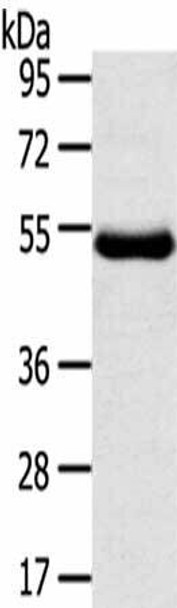 TMPRSS11D Antibody (PACO17284)