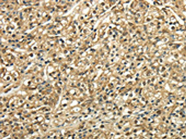 TSC22D1 Antibody (PACO17333)