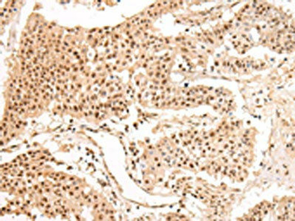 SWAP70 Antibody (PACO17382)