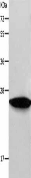 RAB38 Antibody (PACO17514)