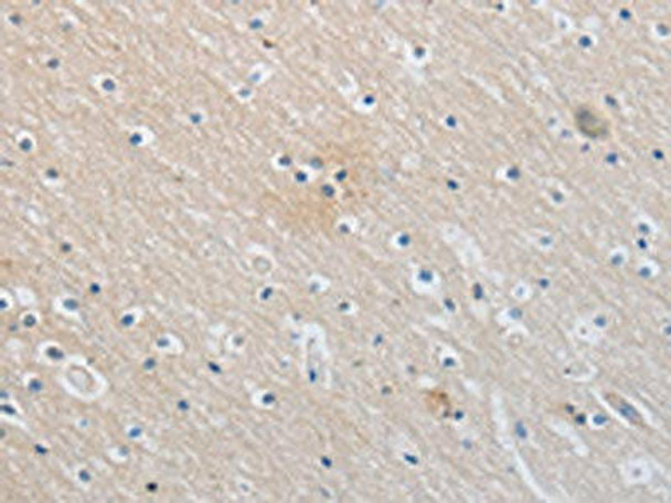 SLC16A7 Antibody (PACO18205)