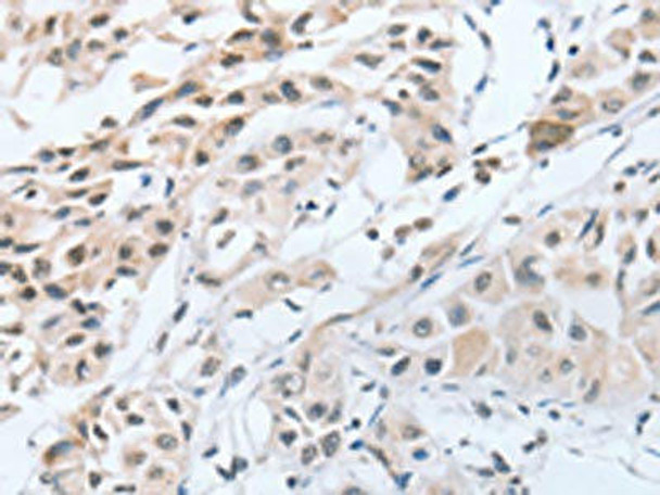 CHRNA10 Antibody (PACO18264)