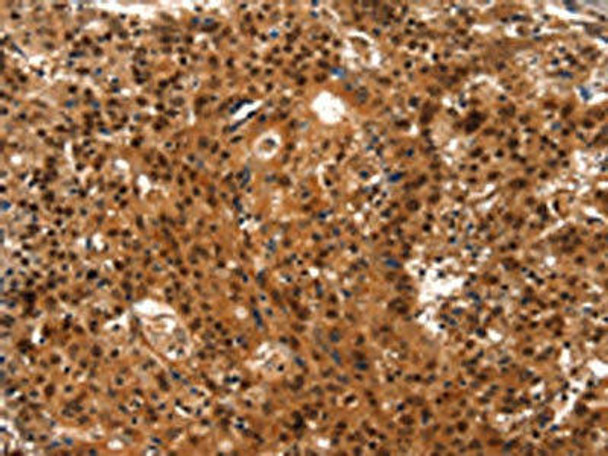 LIN28A Antibody (PACO18594)