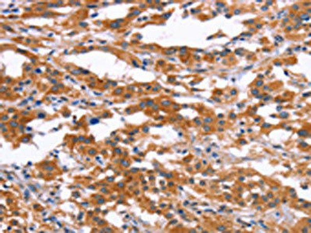 RPS6KA6 Antibody (PACO18625)