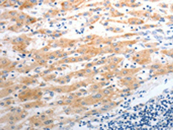 SLC22A6 Antibody (PACO18789)